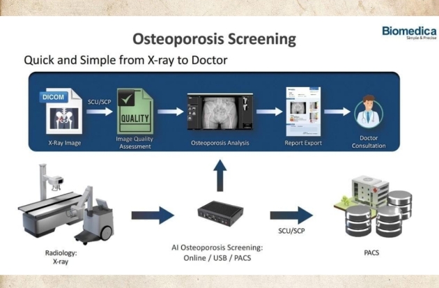 OsteoCloud: Teknologi AI yang Mempercepat Deteksi Dini Osteoporosis dalam 6 Detik