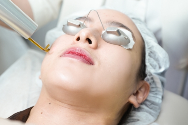 Tangani Hiperpigmentasi Kulit dengan Pendekatan Miracle Aesthetic Clinic