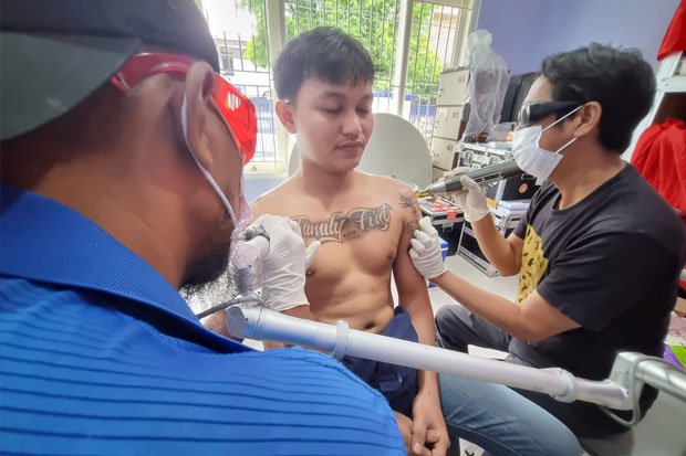 40 Orang Peserta Ikut Program Hapus Tato di Makassar