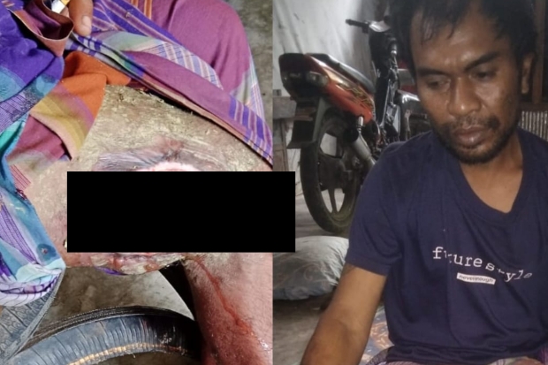 Derita Luka Serius di Lutut, Warga Borongtala Jeneponto Butuh Uluran Tangan