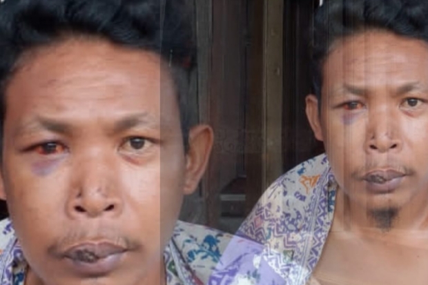 Korban Penganiayaan di Jeneponto Tuntut Polisi Tangkap Pelaku: Saya Nyaris Mati