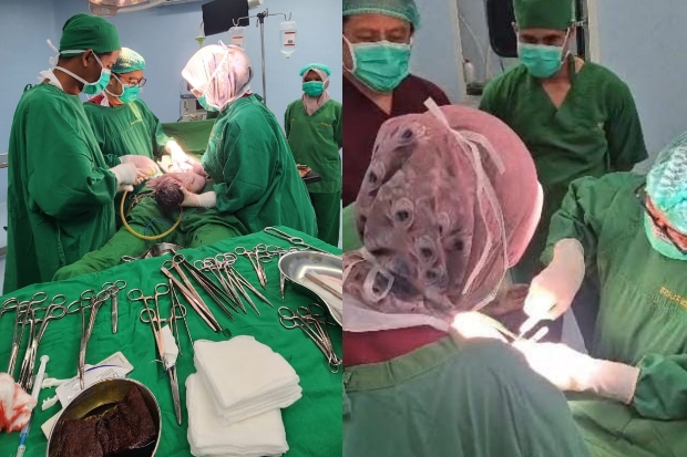 Tim Medis Unhas Lakukan Tiga Operasi Sesar Korban Bencana di Pidie