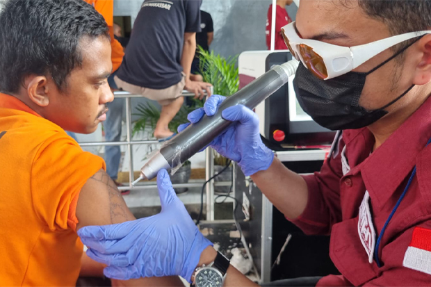 Hapus Tato Gratis Hadir di Sulbar, Sasar Warga Binaan Lapas Polman