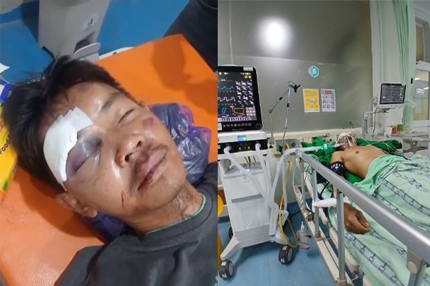 Tolong! Korban Tabrak Lari di Gowa Koma 5 Hari, Polisi Belum Berhasil Temukan Pelaku